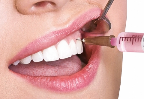 Những tác dụng phụ của thuốc gây tê khi nhổ răng nên biết